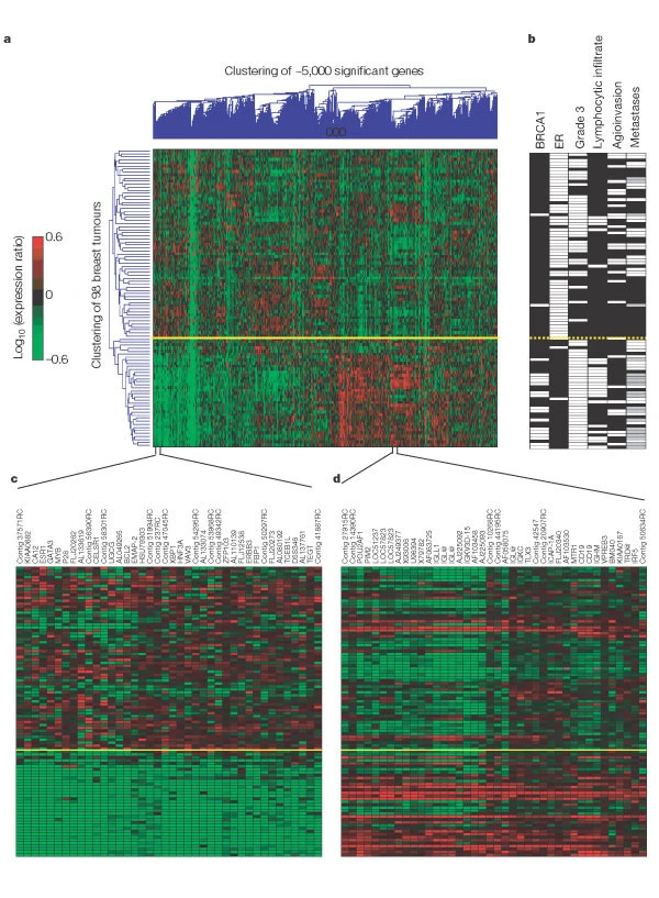 Cluster analysis of breast tumours