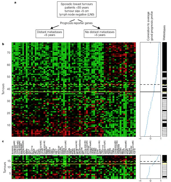 Prognostic signature of breast tumours